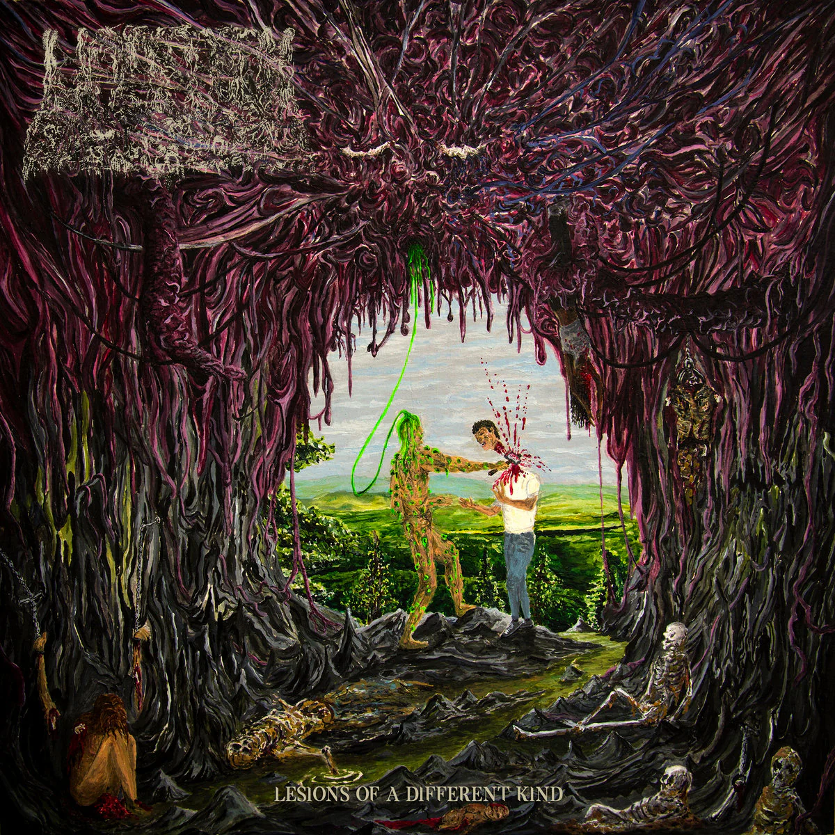 Undeath "Lesions Of A Different Kind"